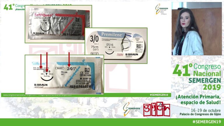 Ejemplos de Cirug&iacute;as Menores y su Aplicaci&oacute;n