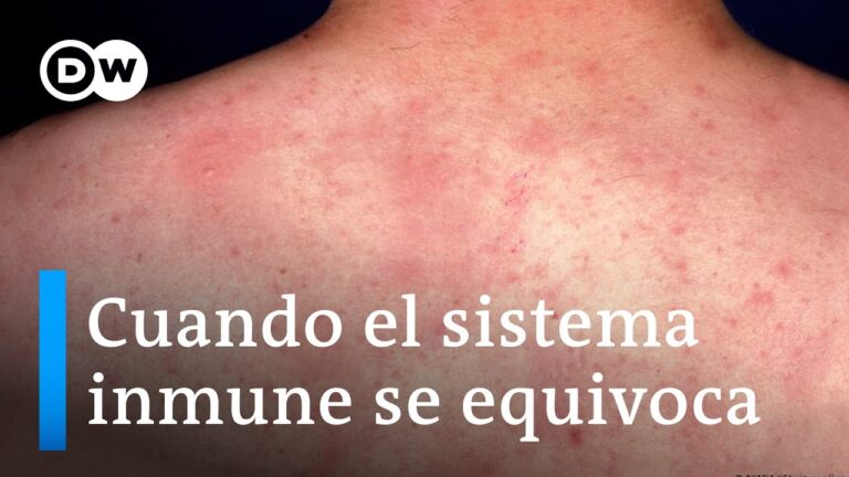 Cu&aacute;les son los 4 Tipos de Alergia y C&oacute;mo Identificarlos